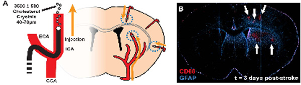 Schematic and 3 day representative image of diffuse lacunar infarction model in rodents