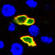 Stem Cell Quiescence and RNA Stability